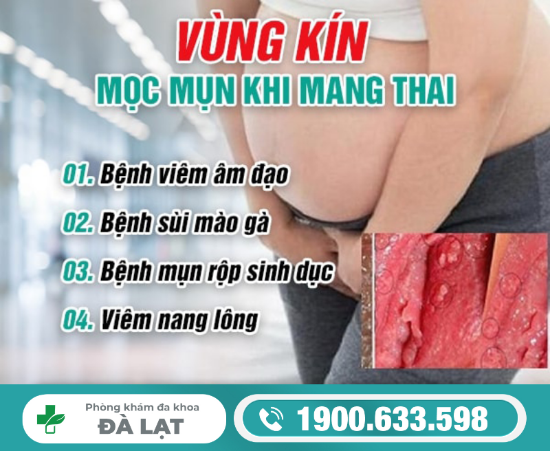 Hình ảnh minh họa